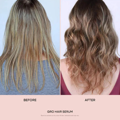 Vegamour  GRO Hair Serum for Thinning Hair