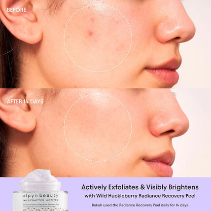 ALPYN  Polishing Peel & Brightening Face Mask with 8 Acids & Huckleberry