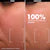 HYDRATE - Hydrating Balmy Rich Cream Refillable Moisturizer with Lipids +