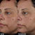 Faded Tranexamic Acid Dark Spot Patches for Hyperpigmentation 222 |