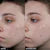 Faded Tranexamic Acid Dark Spot Patches for Hyperpigmentation 222 |